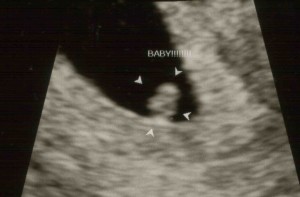 ultrasound1